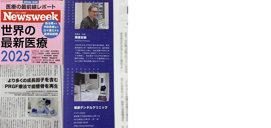 Newsweek「世界の最新医療2025」号（2025年3月31日発売）で、PRGFインストラクターの塚原宏泰先生がPRGFの紹介をしてくださいました